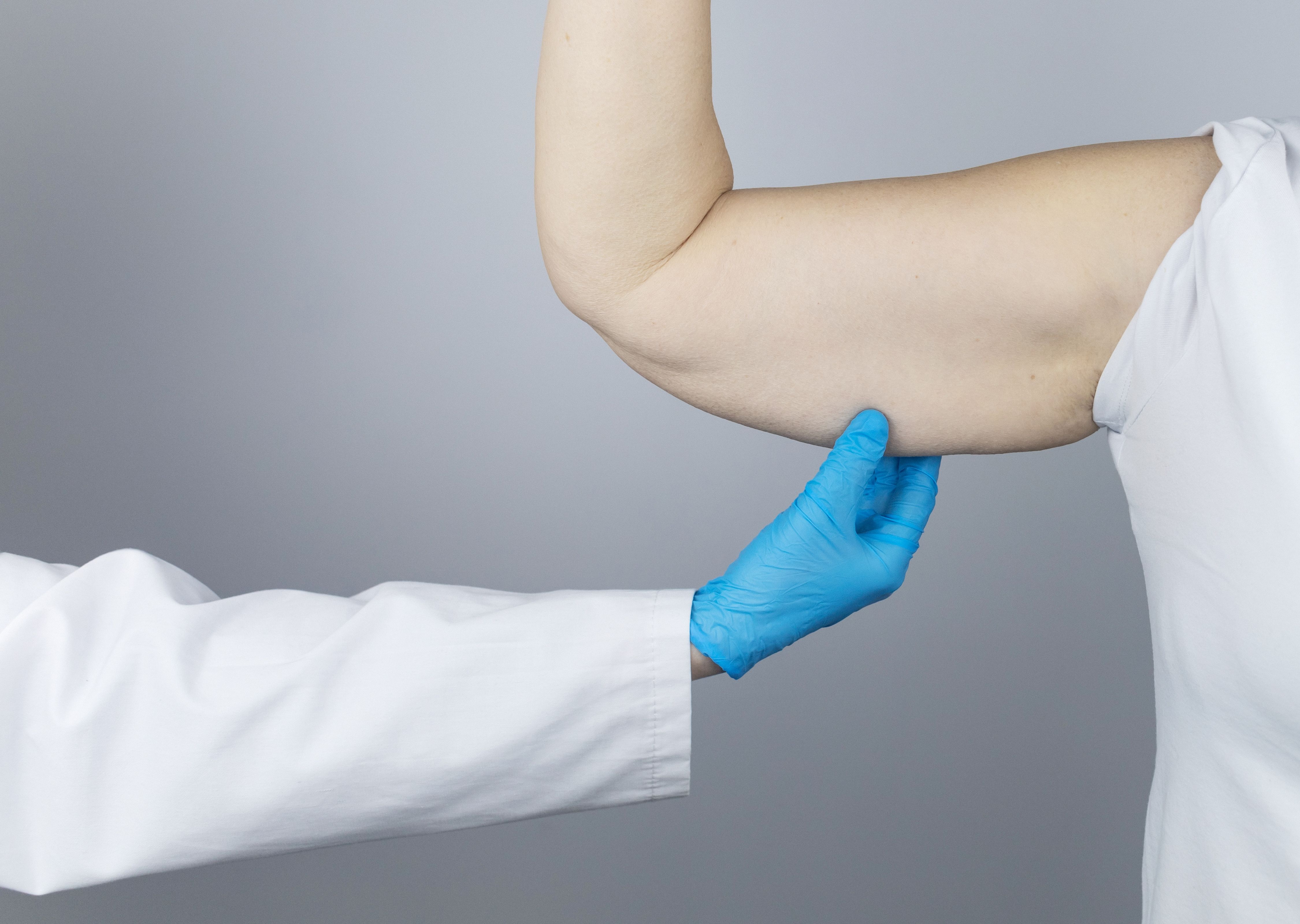 Arm-lift-surgery-Brachioplasty-description-reviews.jpg