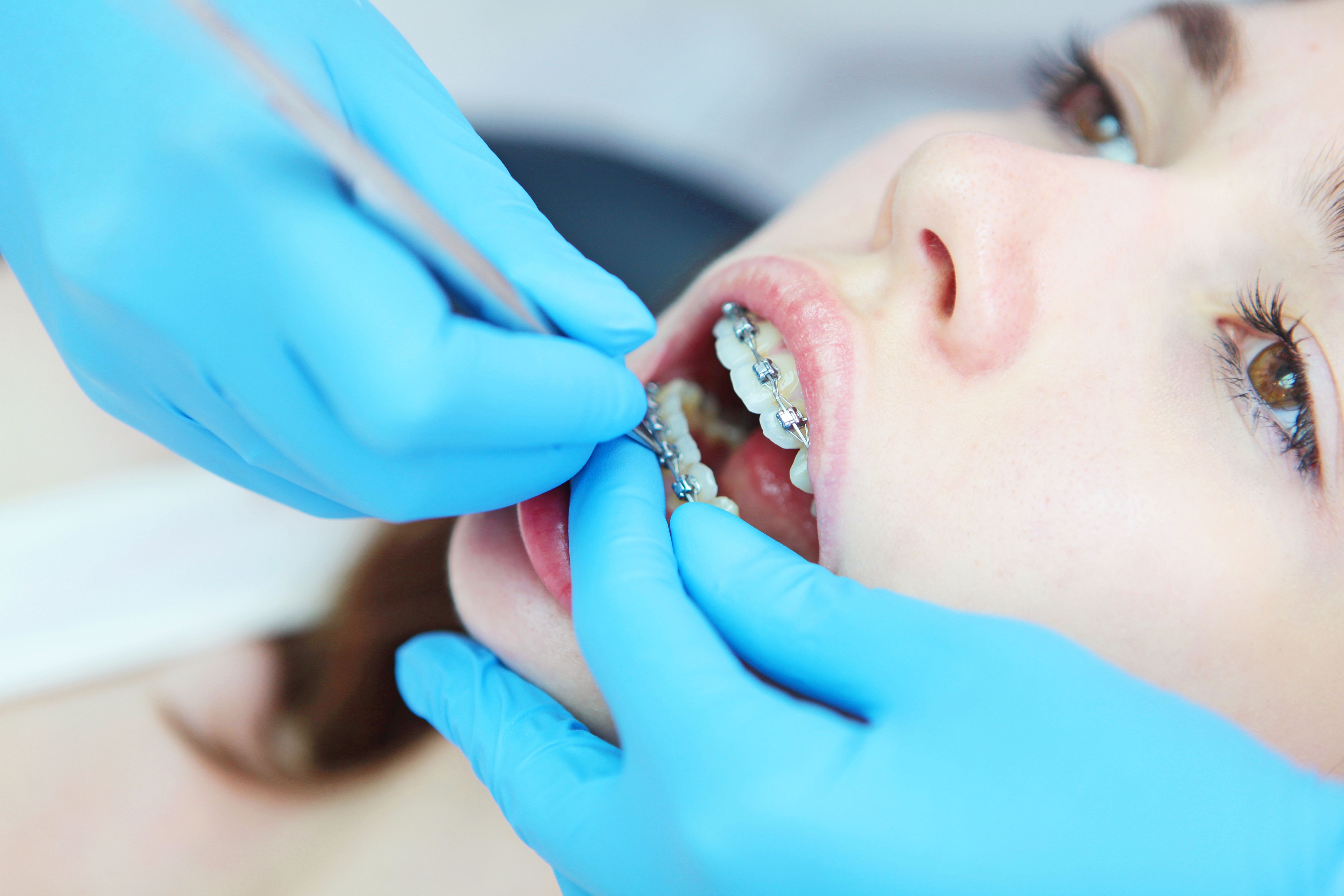 Braces-reviews-best-doctor.jpg