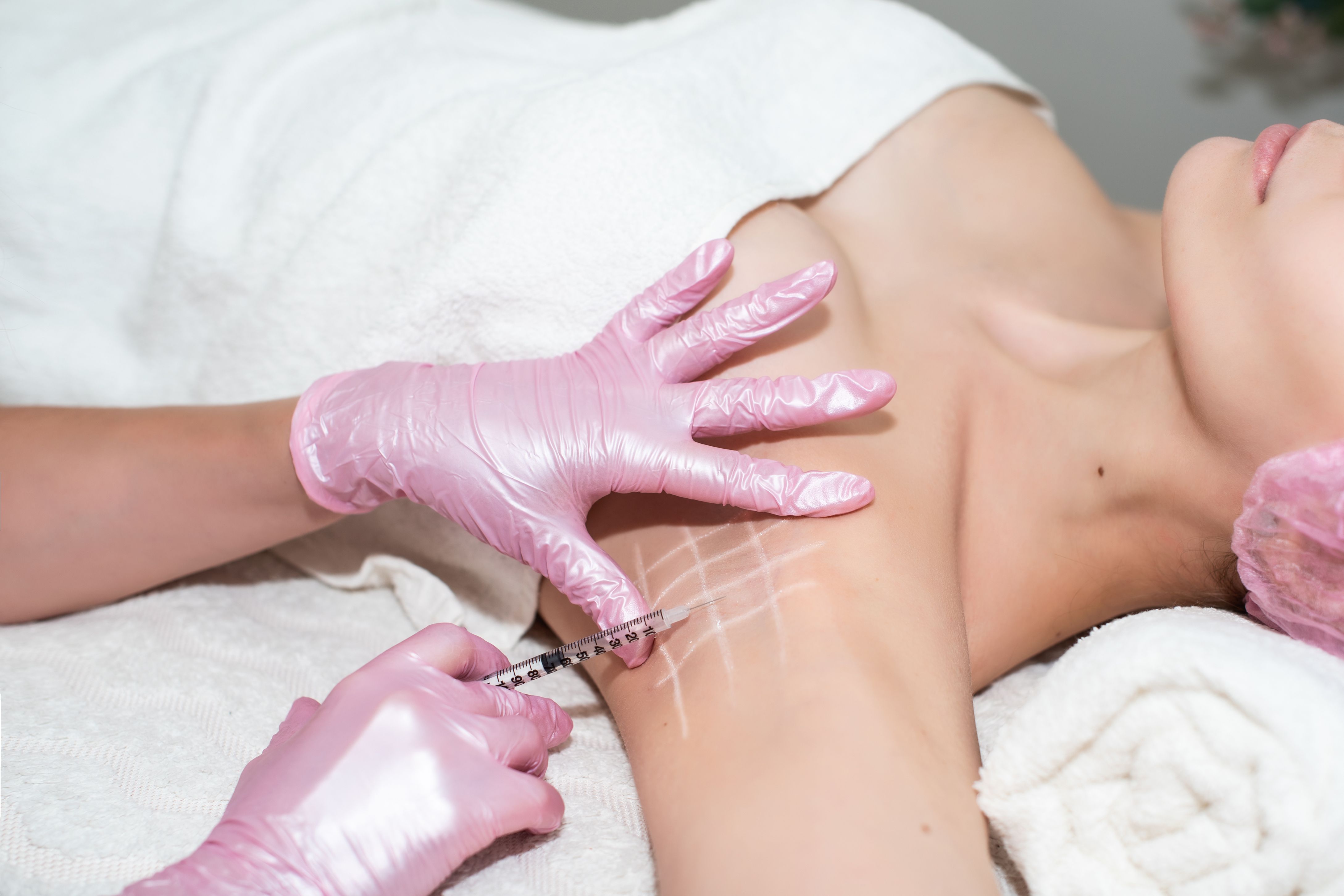 Botox-injections-armpits-body-reviews.jpg
