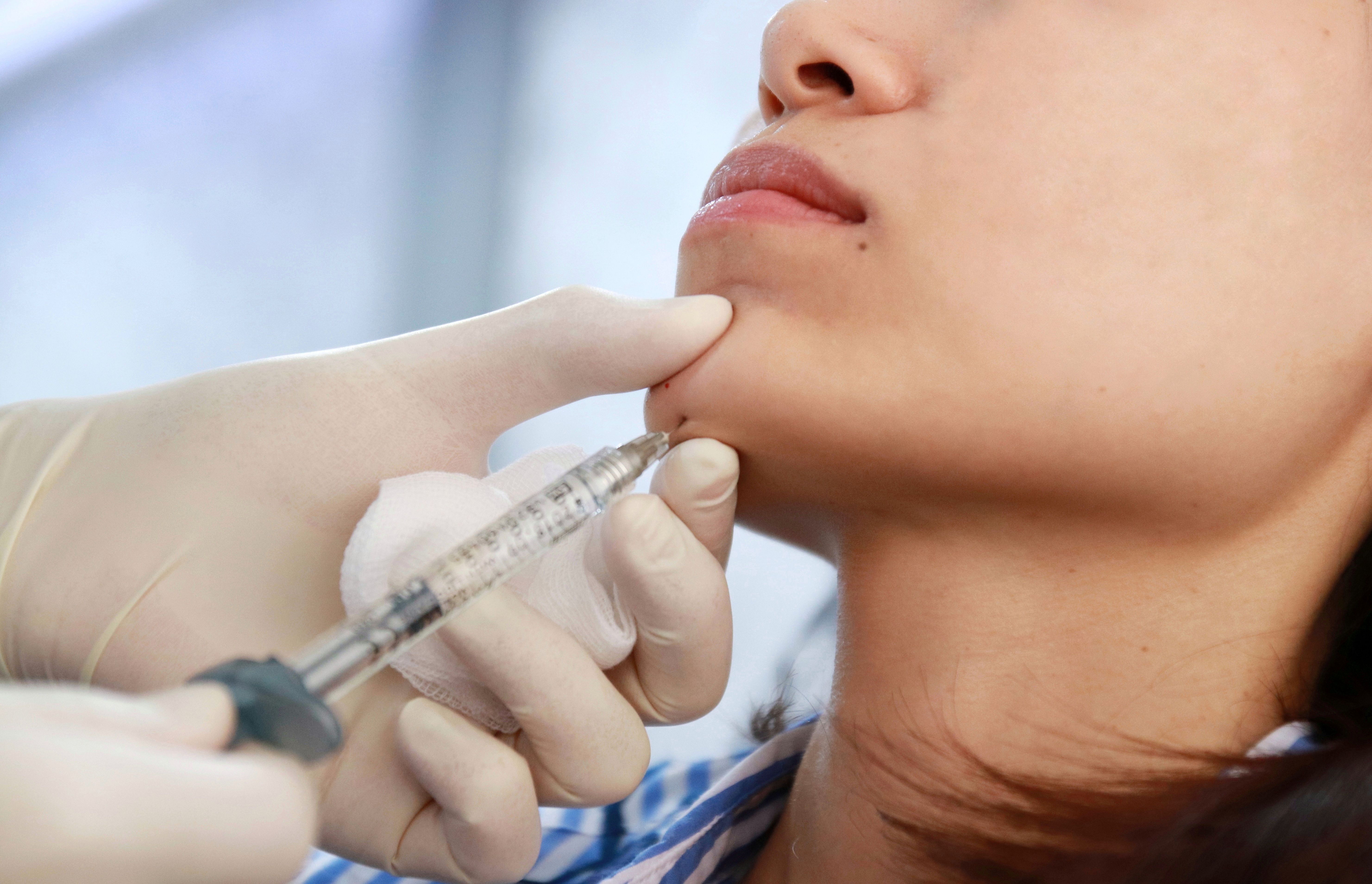 Chin-fillers-chin-injections-reviews-injector.jpg