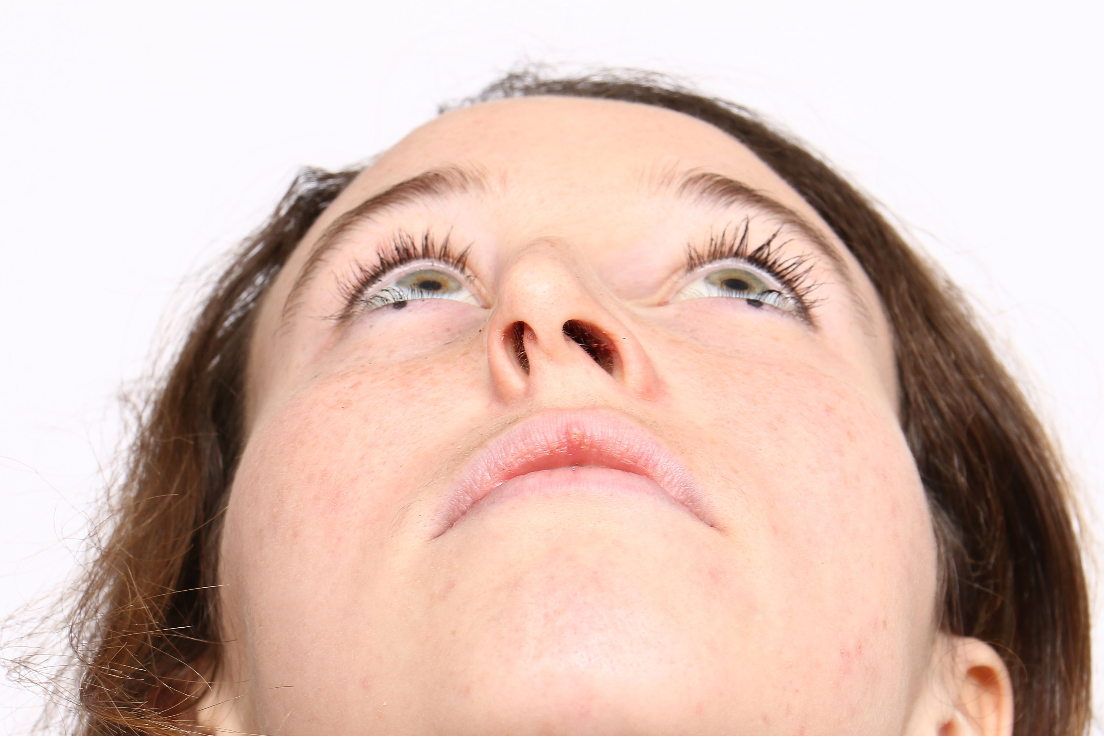 septoplasty:rhinoplasty:plasticsurgeon.jpg