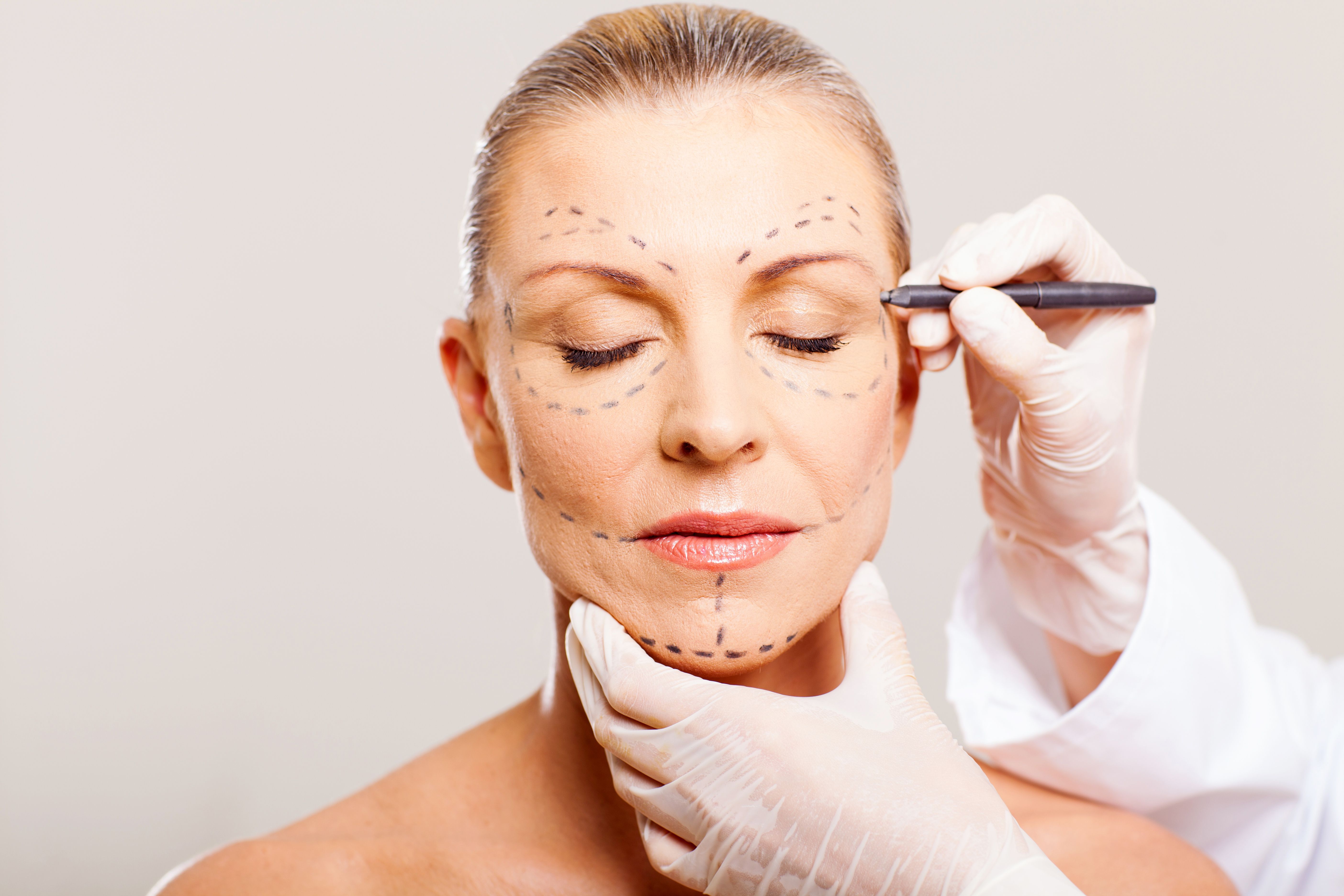 face-lift-surgery-description-reviews-plastic-surgeon.jpg