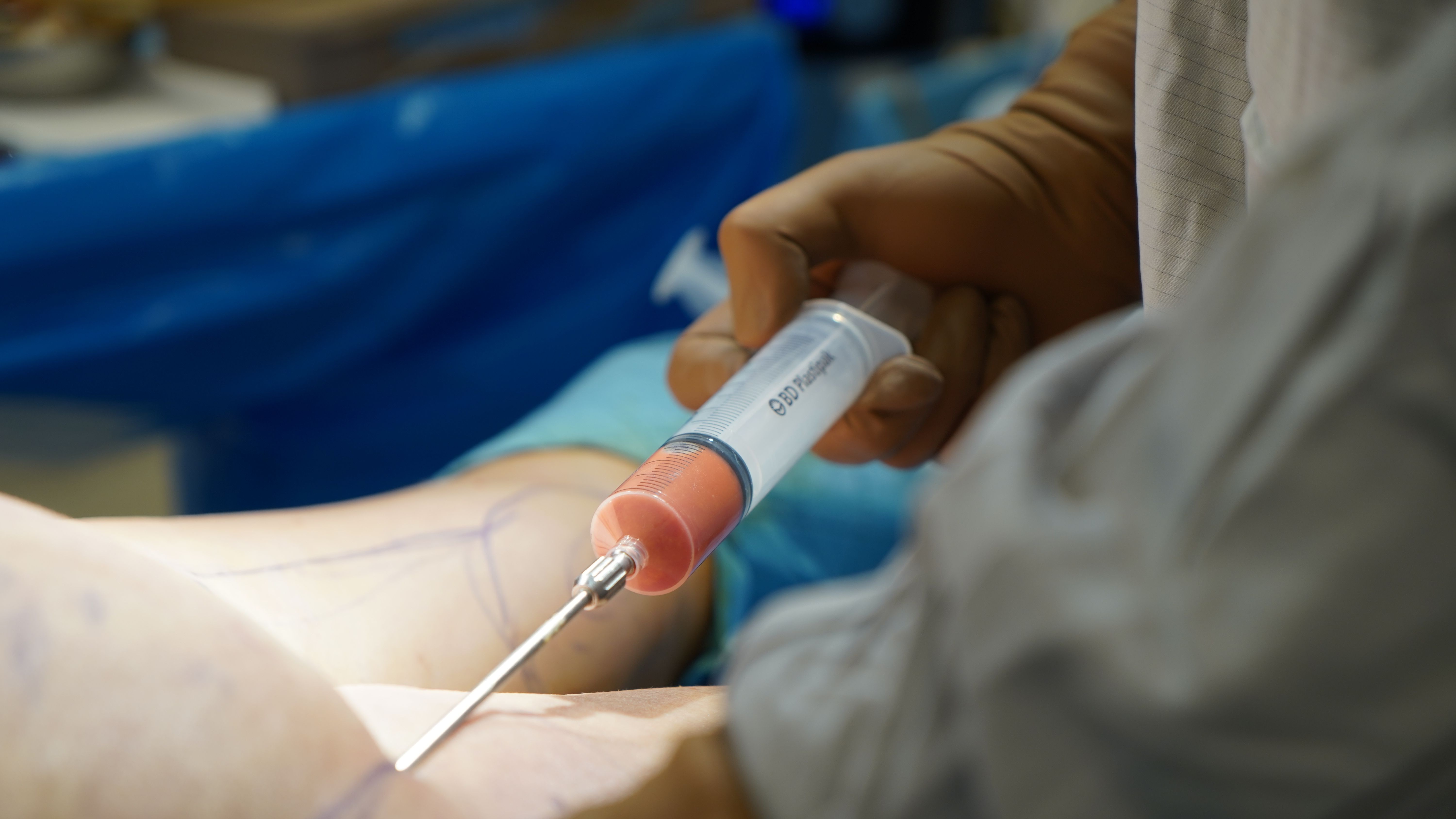 Brazilian-butt-lift-Revision-BBL-surgery-reviews-best-surgeon.jpg